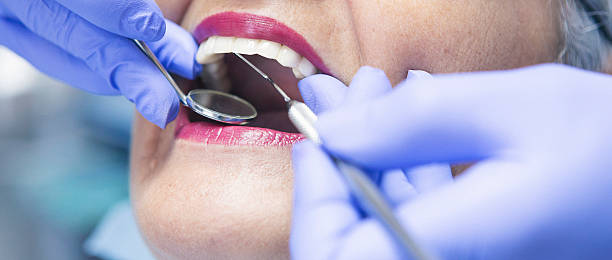 Best Urgent Care for Lost Fillings or Crowns in Loudonville, OH